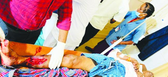 ಬೆಂಡಿಗೇರಿ ಪೆಟ್ರೊಲ್ ಬಂಕ್ ಹತ್ತಿರ ಭೀಕರ ಅಪಘಾತ ಓರ್ವನ ಕಾಲಿಗೆ ತೀವ್ರ ಗಾಯ    