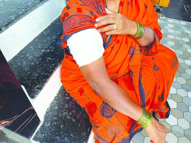 ಮನೆಗೆ ಬಂದು ಮಹಿಳೆಗೆ ಕುತ್ತು ತಂದ ಮಂಗಗಳು    