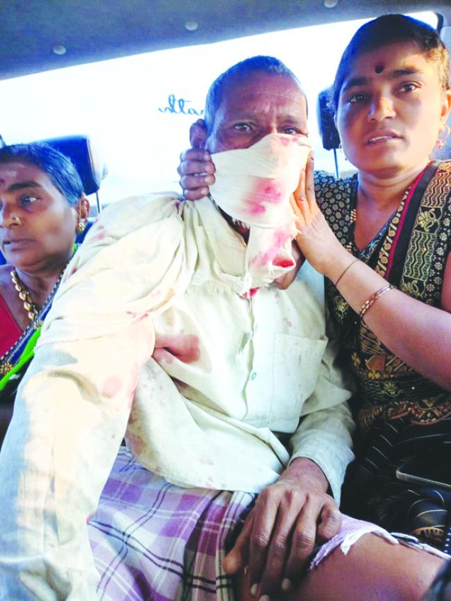 ಮಣಂಕಲಗಿ ಗ್ರಾಮದ ಹೊರವಲಯದಲ್ಲಿ ಚಿರತೆ ಪ್ರತ್ಯಕ್ಷ: ಇಬ್ಬರ ಮೇಲೆ ದಾಳಿ