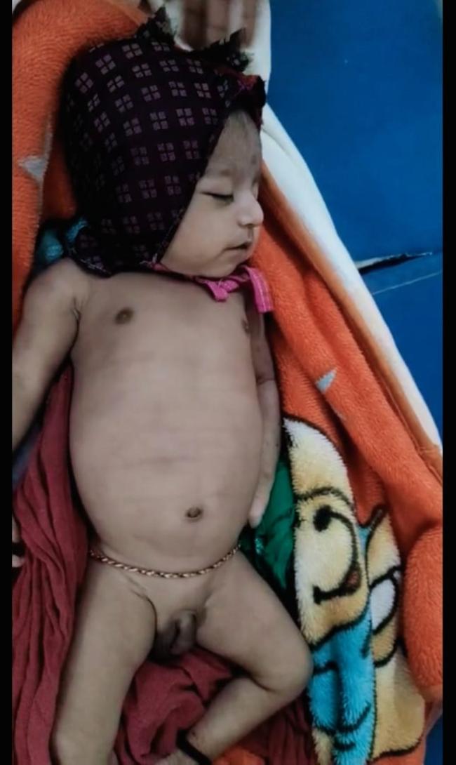 ವೈದ್ಯರ ನಿರ್ಲಕ್ಷಕ್ಕೆ ಹಸುಗೂಸು ಸಾವು:ಕುಟುಂಬಸ್ಥರ ಆರೋಪ