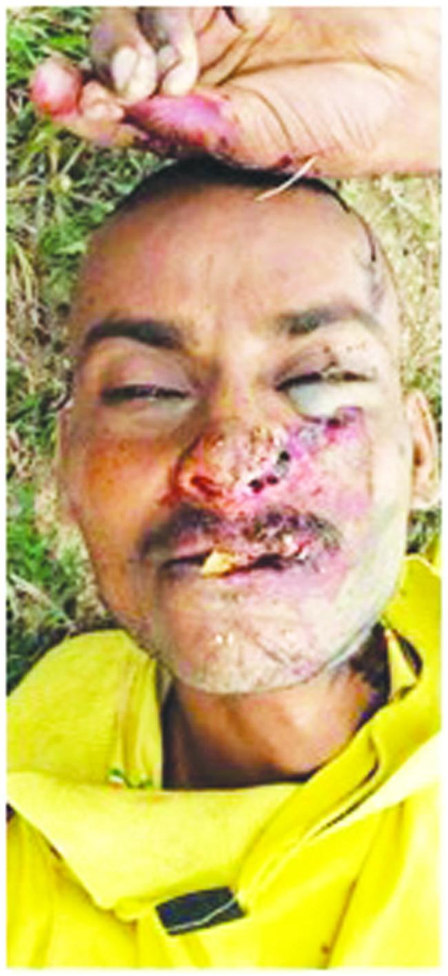 ಅಪರಿಚಿತ ಶವದ ವಾರಸುದಾರರ ಪತ್ತೆಗೆ ಮನವಿ 