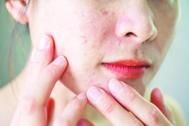 ವಿಶ್ವಚರ್ಮ ಆರೋಗ್ಯ ದಿನ: ಜು. 11, 12ರಂದು ಉಚಿತ ತಪಾಸಣೆ ಶಿಬಿರ 