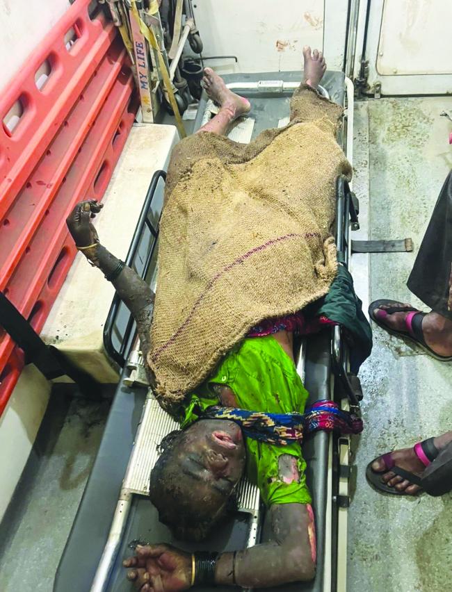 ಮನೆಗೆ ಬೆಂಕಿ: ಏಕಾಂಗಿಯಾಗಿ ವಾಸಿಸುತ್ತಿದ್ದ ವೃದ್ಧೆ ಸಾವು  