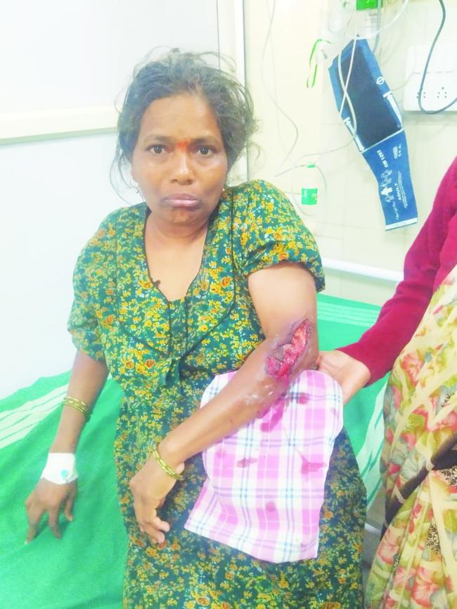 ವಾಣಿಜ್ಯ ನಗರದ ಬಡಾವಣೆಗಳಲ್ಲಿ ಹುಚ್ಚುನಾಯಿ ದಾಳಿ : ನಾಗರಿಕರ ಆಕ್ರೋಶ, ಎಚ್ಚೆತ್ತ ಆಡಳಿತ- ಬಂಧನಕ್ಕೆ ಮುಂದಾದ ಅಧಿಕಾರಿಗಳು