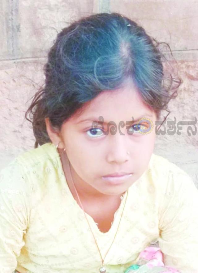 ಶಾಲೆಗೆ ಹೋಗುವ ವಿದ್ಯಾರ್ಥಿನಿ ಮೇಲೆ ನಾಯಿ ದಾಳಿ 