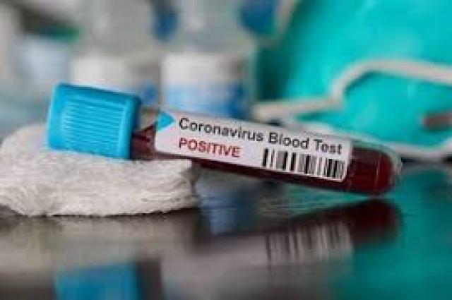  ಪಶ್ಚಿಮ ಬಂಗಾಳದಲ್ಲಿ ಕೊರೊನಾದಿಂದ ಸತ್ತವರ ಸಂಖ್ಯೆ 88ಕ್ಕೆ ಏರಿಕೆ